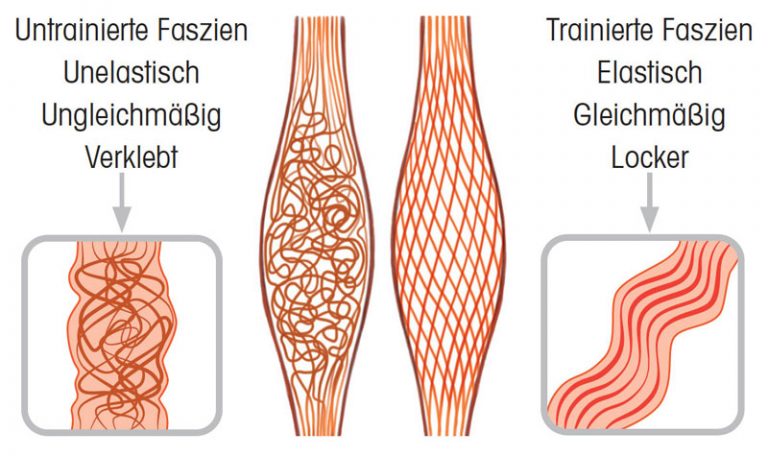 Trainierte und untrainierte Faszien